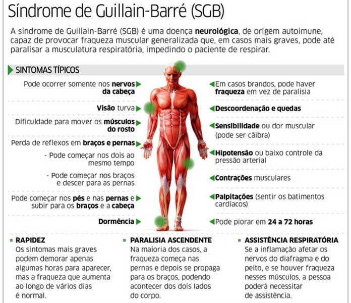 ¿Qué es el Síndrome de Guillain–Barré?
