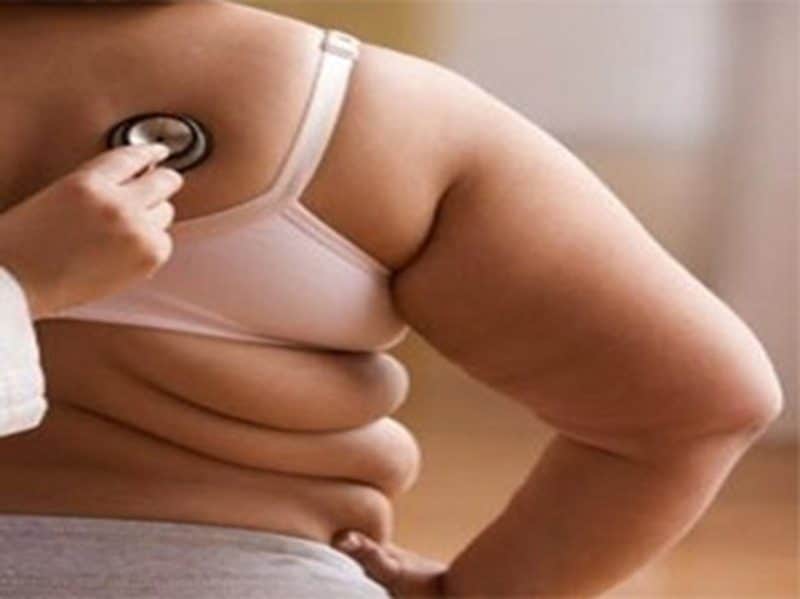 Epidemia de obesidad crece en EEUU