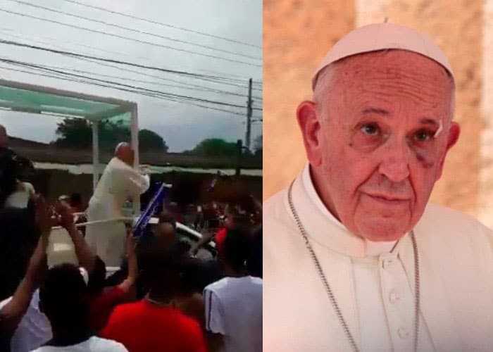 El Papa Francisco sufre golpe en el rostro por accidente