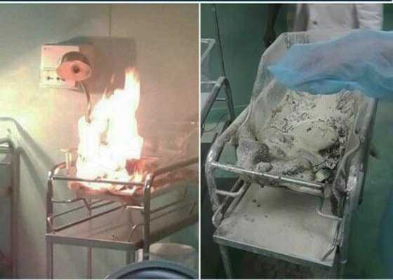 Muere recién nacido resultó quemado en incubadora