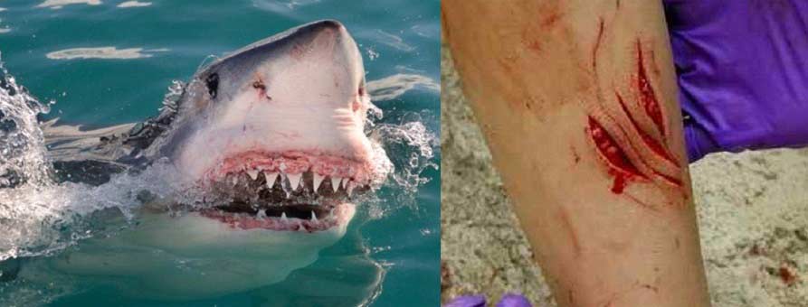Tiburones atacan dos menores en playas NY