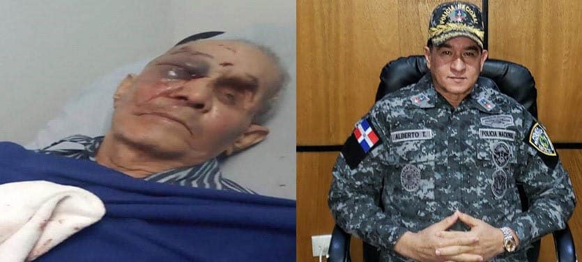 Condenan golpiza a hombre 85 años en Santiago