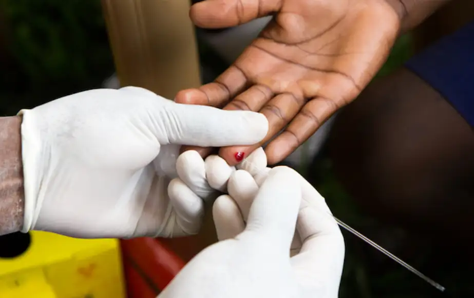 En RD hay 72,000 personas con VIH