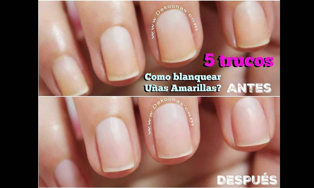 unas amarillas antes despues